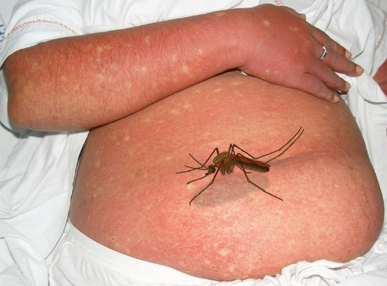 ६४ वर्ष पछि फेला पर्यो अनौठो चरा, आधा मानिस, आधा पंक्षी !