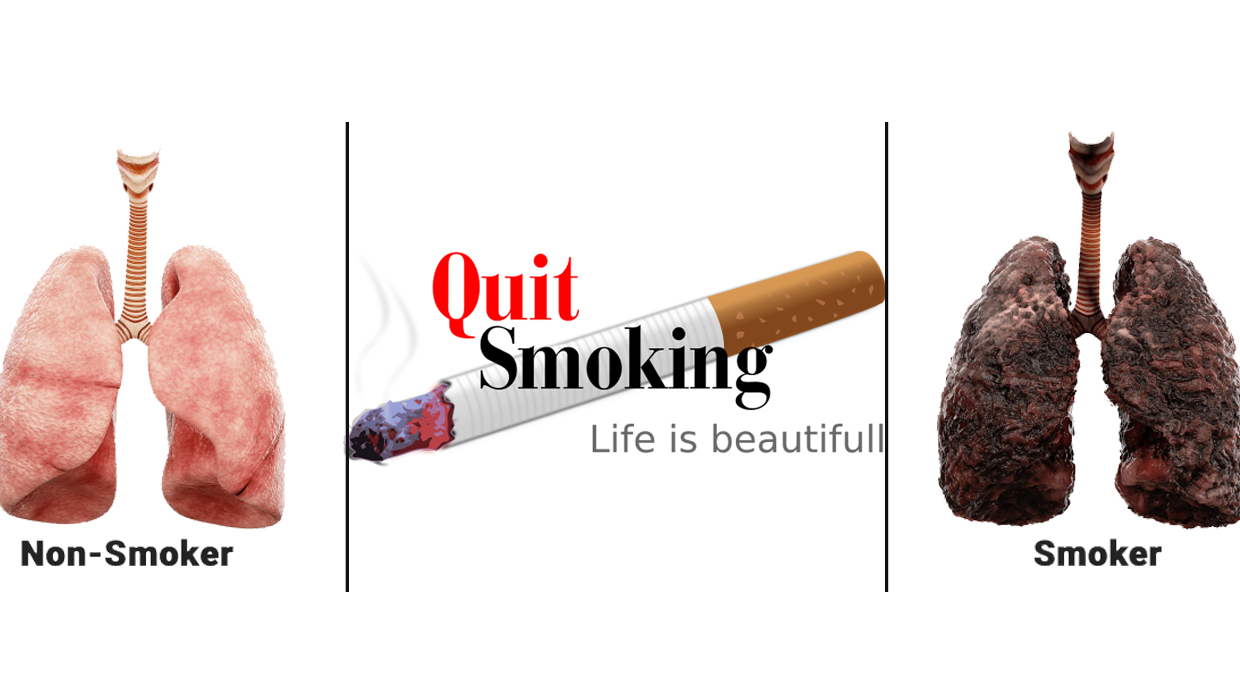 ६४ वर्ष पछि फेला पर्यो अनौठो चरा, आधा मानिस, आधा पंक्षी !